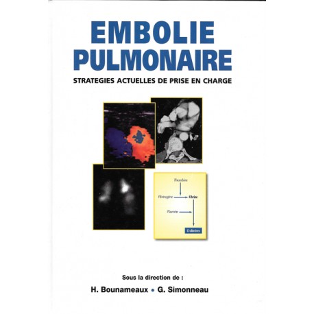 Embolie pulmonaire