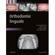 Orthodontie linguale