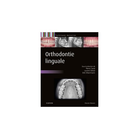 Orthodontie linguale