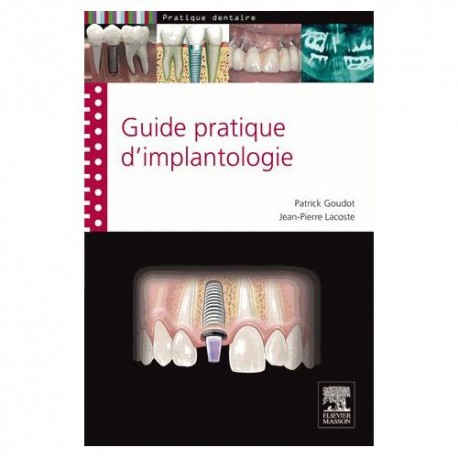 Guide pratique d'implantologie