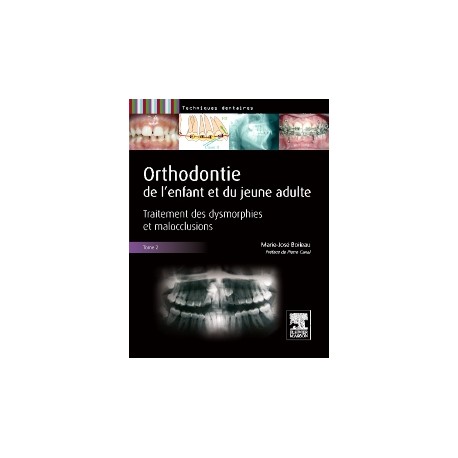 Orthodontie de l'enfant et du jeune adulte -Tome 2