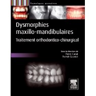 Dysmorphies maxillo-mandibulaires