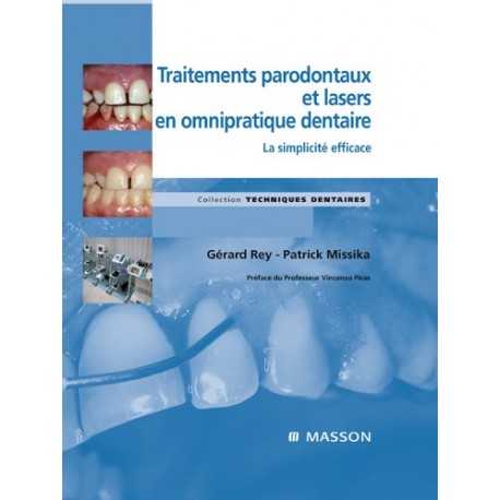 Traitements parodontaux et lasers en omnipratique dentaire
